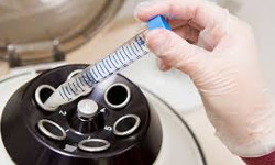 male fertility and semen analysis centrifuge machine